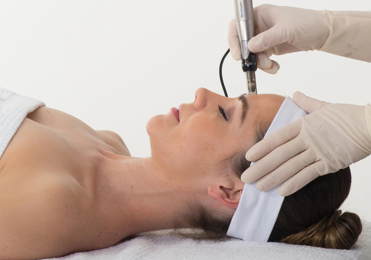 Beneficiile dermapenului cu exozomi